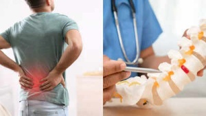 Is It a Slipped Disc or Just Back Pain? Key Differences to Know